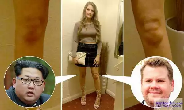OMG!! Meet The 22-yr-old Lady Who Sees Celebrity Faces On Her KNEES